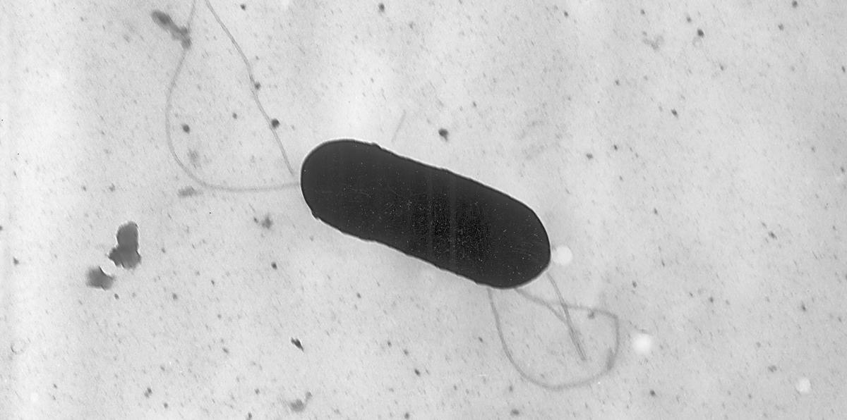 Esta imagen tomada con un microscopio electrónico y facilitada por los Centros para el Control y la Prevención de Enfermedades muestra una bacteria Listeria monocytogenes que causa la listeriosis.