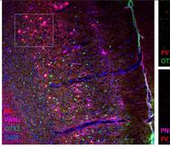 En la imagen, de la Universidad Autónoma de Madrid, la proteína "OTX2" en verde internalizándose en las neuronas (rojo) de la corteza prefrontal que están rodeadas de redes perineuronales (rosa).