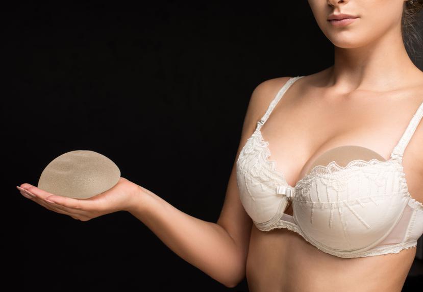 El aumento de senos fue el quinto procedimiento estético invasivo más realizado en Estados Unidos el año pasado.