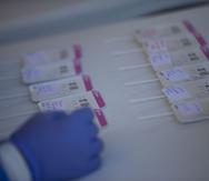 Algunas muestras de pruebas de antígenos durante un evento reciente.