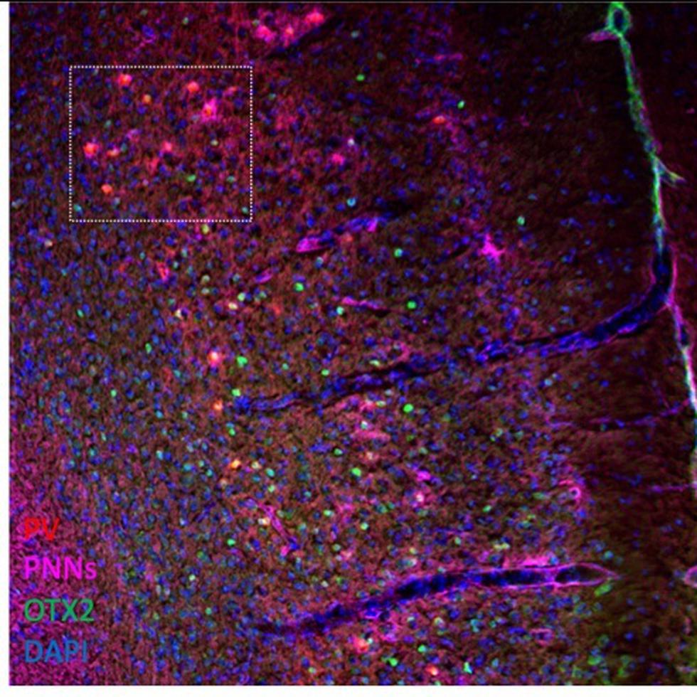 En la imagen, de la Universidad Autónoma de Madrid, la proteína "OTX2" en verde internalizándose en las neuronas (rojo) de la corteza prefrontal que están rodeadas de redes perineuronales (rosa).
