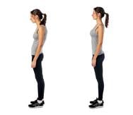 El hábito de adoptar mala postura puede ocasionar un alineamiento corporal desbalanceado. (Foto: Shutterstock.com)