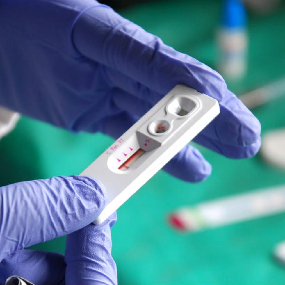 El Departamento de Salud recomienda la realización de la prueba de VIH, al menos, una vez al año.