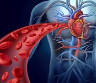 Existe una asociación entre el aumento de grasa epicárdica y el desarrollo de enfermedad coronaria.