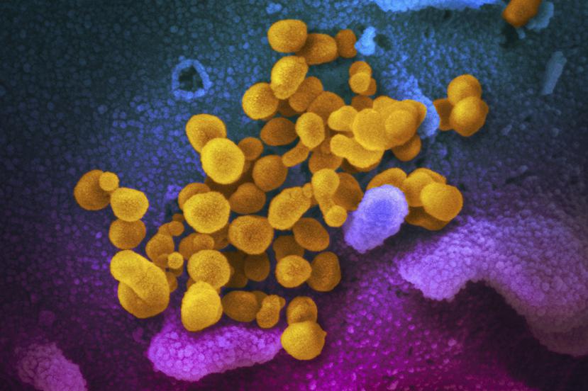 Imagen de archivo del Instituto Nacional de Salud de Estados Unidos que muestra las células del nuevo coronavirus (amarillas).