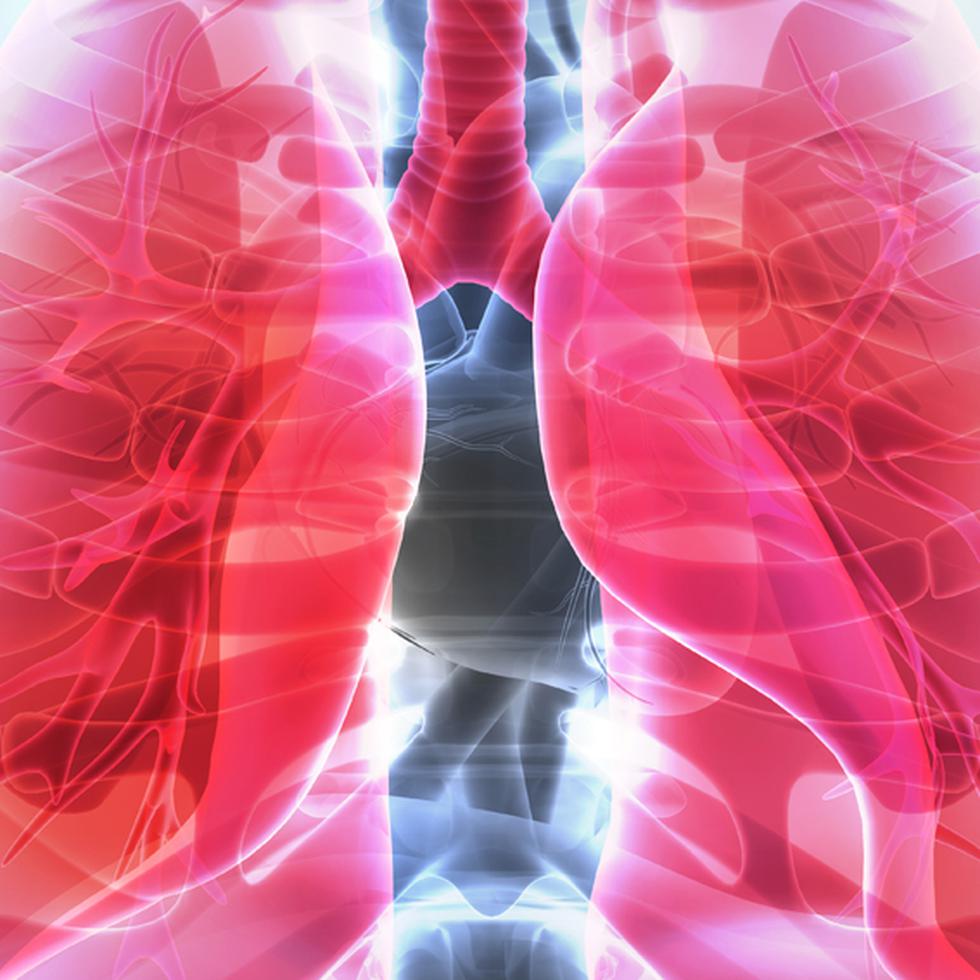 Una de las dificultades del cáncer de pulmón es que tiende a presentarse en una etapa avanzada con  una mortalidad relativamente alta. (Foto Shutterstock)