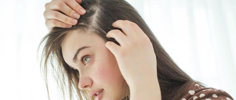 La nutrición es determinante para prevenir la caída difusa del cabello, problema al que los médicos llaman efluvio telógeno, que afecta más a mujeres. (Shutterstock)