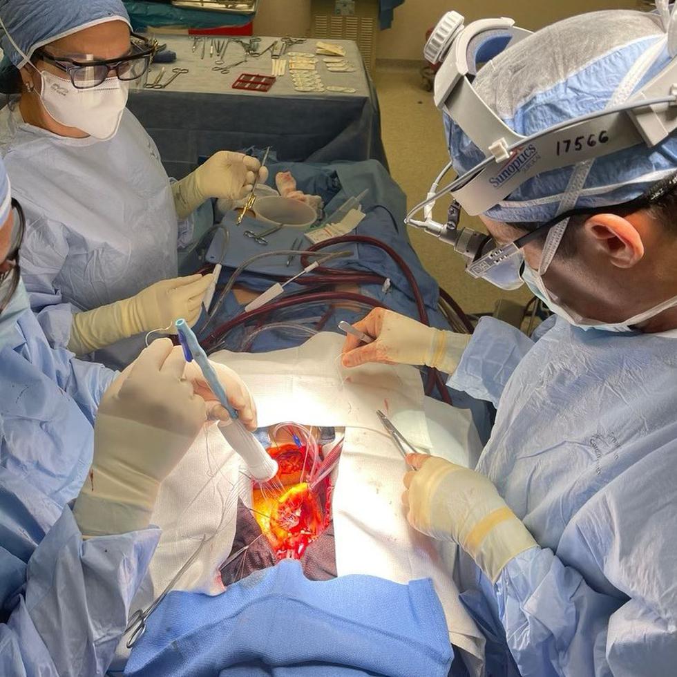 El cirujano cardiovascular Juan Hernández junto a su equipo médico en el Centro Cardiovascular de Puerto Rico durante la cirugía para conectar el conducto Konect-Resilia.