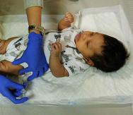 El VSR es la principal causa de infecciones del tracto respiratorio inferior en bebés en el mundo.