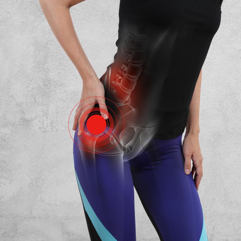 Entre las nuevas técnicas, el abordaje anterior de cadera es la intervención quirúrgica más popular. (Shutterstock)
