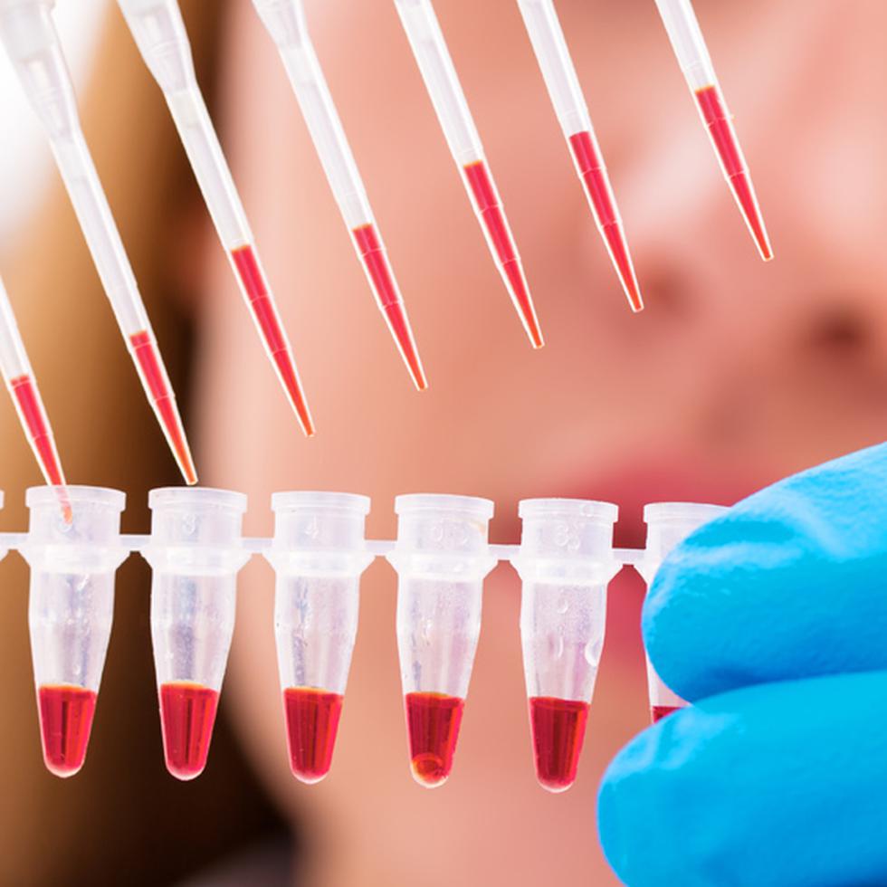 Se utilizaron células madre extraídas de grasas abdominales de los pacientes por liposucción y se inyectaron al pene de los pacientes. (Foto: Shutterstock)