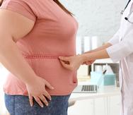 Existen procedimientos médicos para tratar la obesidad. El seguimiento médico es esencial.