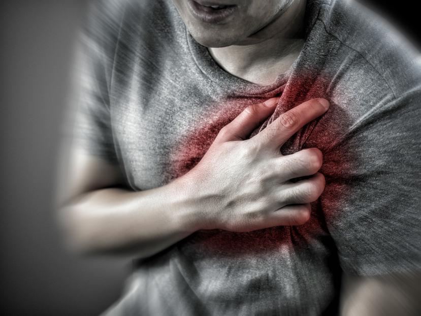 El ataque cardíaco es uno de los efectos dominó de la presión arterial alta.