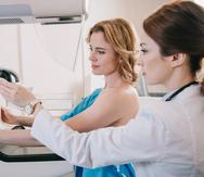 Entre los requisitos, las mujeres interesadas deben haber pasado más de un año de haberse hecho la última mamografía. (Shutterstock)