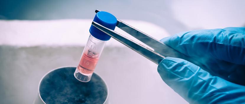 El trasplante de células madre cobra importancia porque, en muchas ocasiones, solo puede realizarse entre familiares compatibles. (Shutterstock)