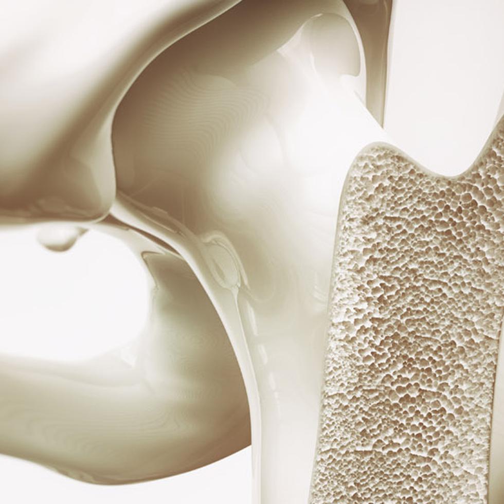 Se calcula que la masa ósea baja y la osteoporosis son una amenaza para la salud pública de casi 44 millones de personas en Estados Unidos. (Shutterstock)