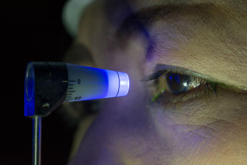 Medir regularmente la presión la intraocular es un aspecto importante para determinar si hay glaucoma. (Foto Shutterstock)