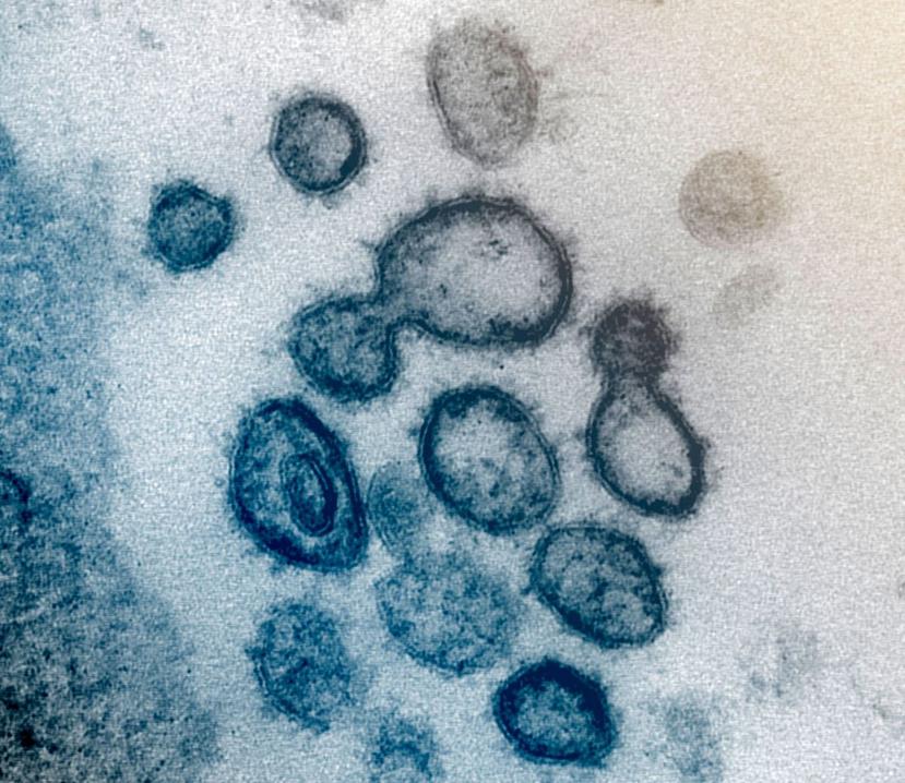 Esta imagen de microscopio electrónico muestra el nuevo coronavirus SARS-CoV-2, también conocido como 2019-nCoV, el virus causa COVID-19. (AP)