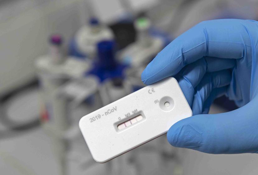 Un kit de prueba rápida para detectar el coronavirus en Alemania. (AP)