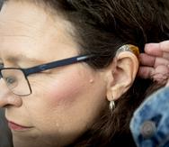 Las prótesis auditivas se podrán adquirir sin receta médica.