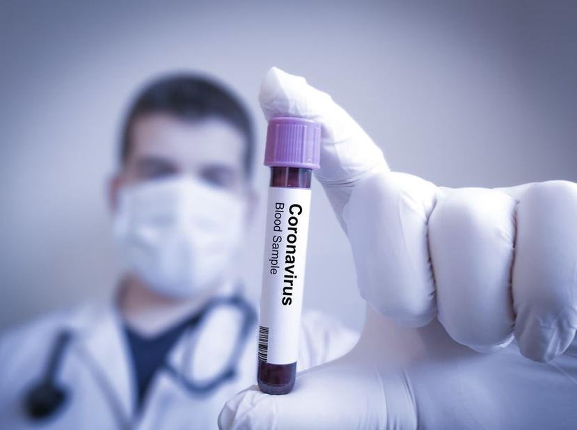 China asegura que probó con éxito una vacuna contra el coronavirus. (Shutterstock)