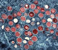 Una micrografía electrónica de transmisión coloreada de partículas de viruela del mono (rojas) encontradas dentro de una célula infectada (azul), cultivadas en el laboratorio en Fort Detrick, Maryland.