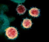 Imagen sin fecha tomada de microscopio electrónico y difundida por los Institutos Nacionales de Salud de EEUU en febrero de 2020 muestra el virus causante del COVID-19.