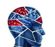 Cuando una zona específica del cerebro realiza una tarea determinada, aumenta el flujo sanguíneo en ella. (Shutterstock)