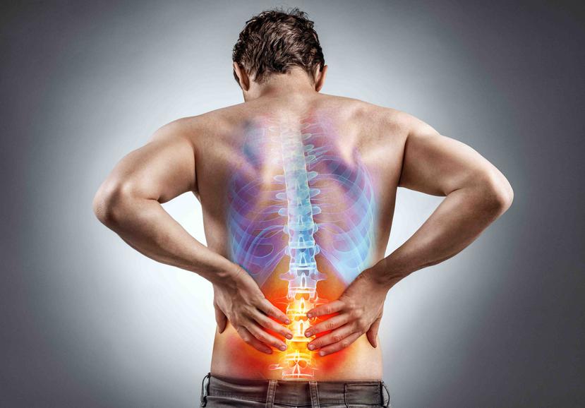 Los dolores crónicos más comunes, entre otros, son los de espalda baja, articulaciones, cuello y cabeza. (Shutterstock)