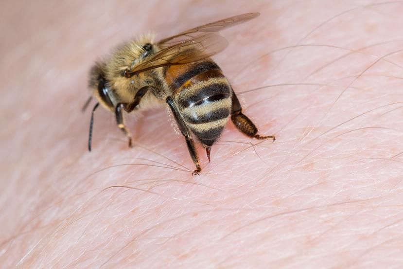 Una abeja picando a una persona.