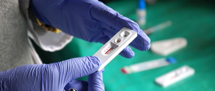 La OMS recomienda a los países con una prevalencia de más del 10 % de casos de resistencia "que revisen de manera urgente sus programas de tratamiento de VIH". (Shutterstock)