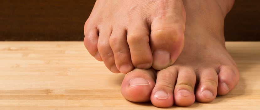 La terapia con láser ha demostrado gran efectividad para curar el hongo en las uñas en decenas de miles de personas. (Shutterstock)