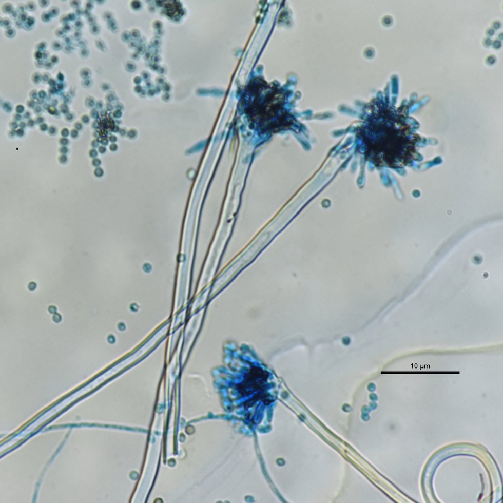 “Aspergillus” es un hongo filamentoso que cuenta con unas 350 especies. Arriba, una captura microscópica del “Aspergillus spp”.