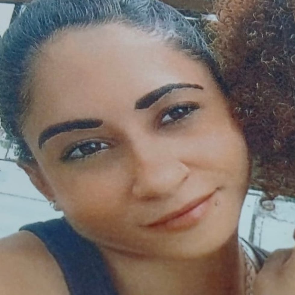 Tiene una cicatriz en el lado derecho de la nariz.