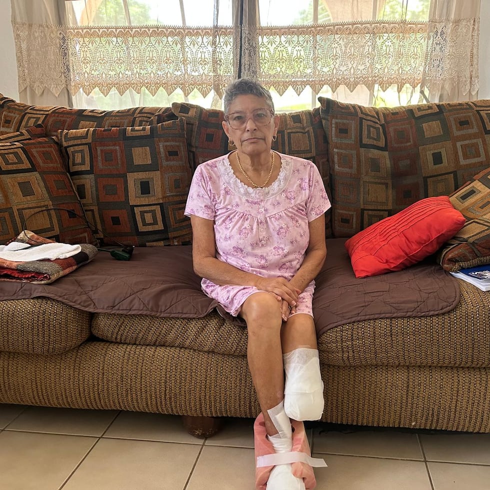 Noema Morales Osorio, de 72 años y residente en Canóvanas, está recién operada de sus piernas y el racionamiento de agua complica su recuperación.