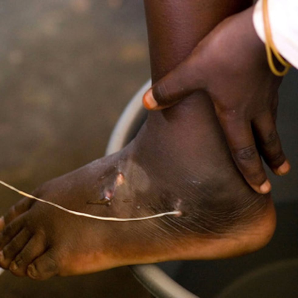 Los 10 casos humanos suponen un descenso del 33% respecto a los 15 casos notificados en 2024. Angola, Camerún, la República Centroafricana y Mali no notificaron ningún caso humano por segundo año consecutivo.