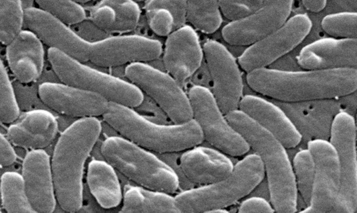 Salud aclara que no hay casos recientes de bacteria "come carne" en Puerto Rico