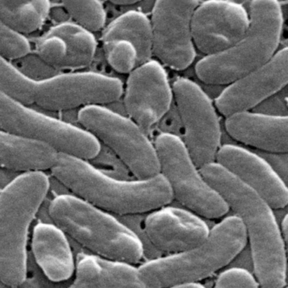 Esta imagen tomada con un microscopio electrónico en 2005, facilitada por los Centros para el Control y la Prevención de Enfermedades, muestra bacterias de la especie Vibrio vulnificus.