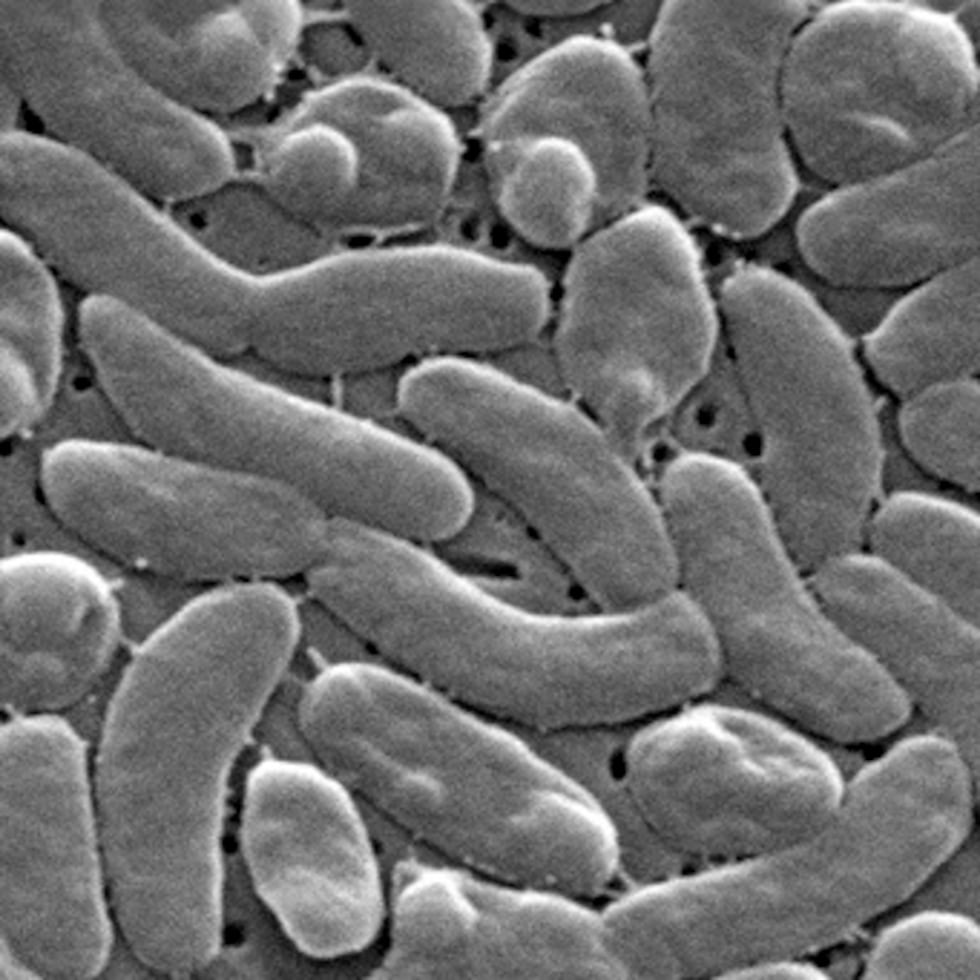 Esta imagen tomada con un microscopio electrónico en 2005, facilitada por los Centros para el Control y la Prevención de Enfermedades de EE. UU. (CDC), muestra bacterias de la especie Vibrio vulnificus.