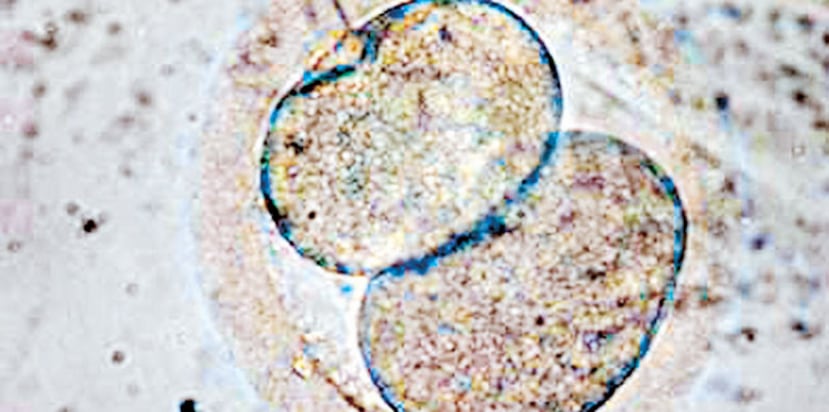 La modificación de embriones sigue siendo una cuestión debatida en el mundo porque si bien parece útil para el tratamiento de enfermedades hereditarias, incluidos algunos tipos de cáncer, podría también ser usada para el diseño de "bebes a la carta" y presentar con ello dilemas éticos. (Archivo)