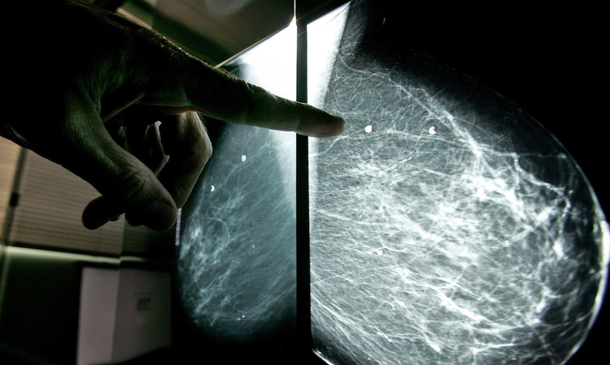 Empresa biofarmacéutica puertorriqueña recibe fondos para desarrollar droga contra cáncer de mama
