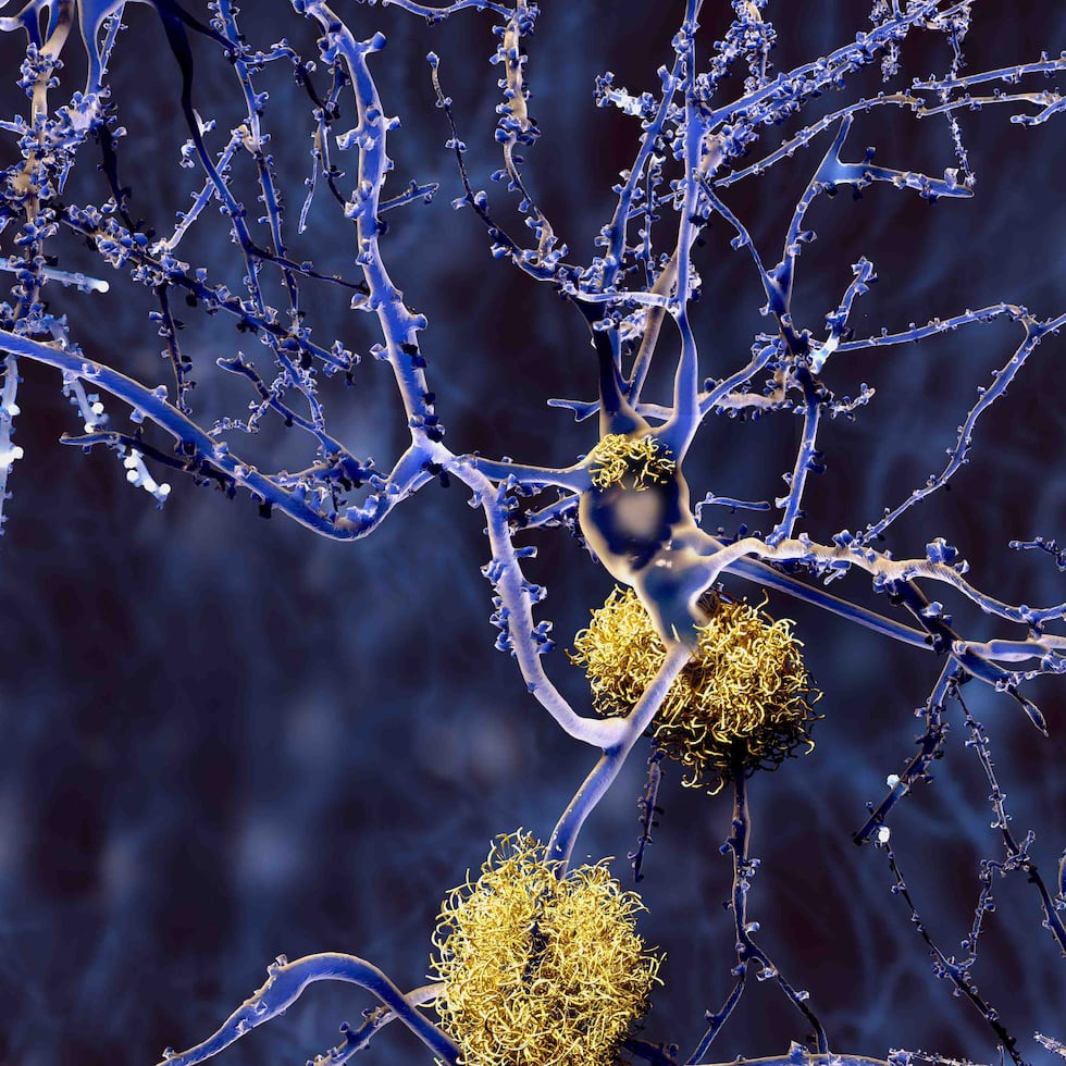 Un equipo de investigadores estadounidenses ha registrado por primera vez la actividad neuronal de cientos de neuronas individuales del hipocampo (la parte del cerebro asociada a la memoria) mientras los pacientes se encontraban bajo anestesia general en cirugías de epilepsia.