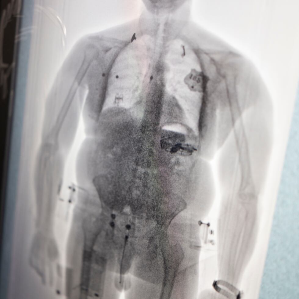 El nuevo dispositivo de rastreo se utilizará en la población correccional, de manera que, cada vez que salgan y entren de las cárceles, puedan ser registrados a través de esa máquina de rayos X.