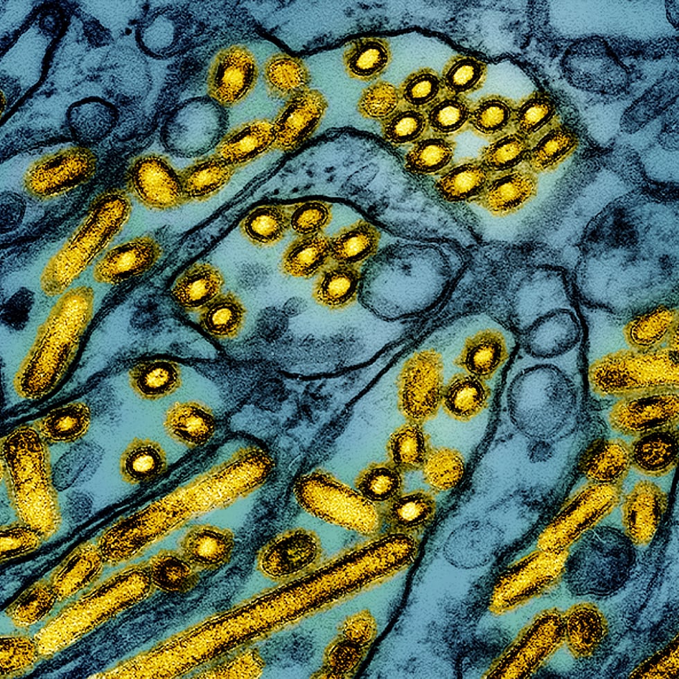 En esta imagen iluminada de un microscopio de electrones difundida por el Instituto Nacional de Alergias y Enfermedades Infecciosas el 26 de marzo de 2024, se muestran partículas del virus de la gripe aviar A H5N1, en amarillo, en células epiteliales (azul).