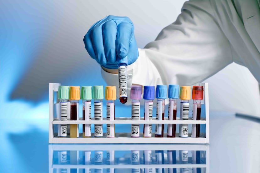 Para que esta prueba sirva para predecir enfermedad coronaria es importante recalcar que debe realizarse cuando la persona esté en buen estado de salud.(Shutterstock.com)