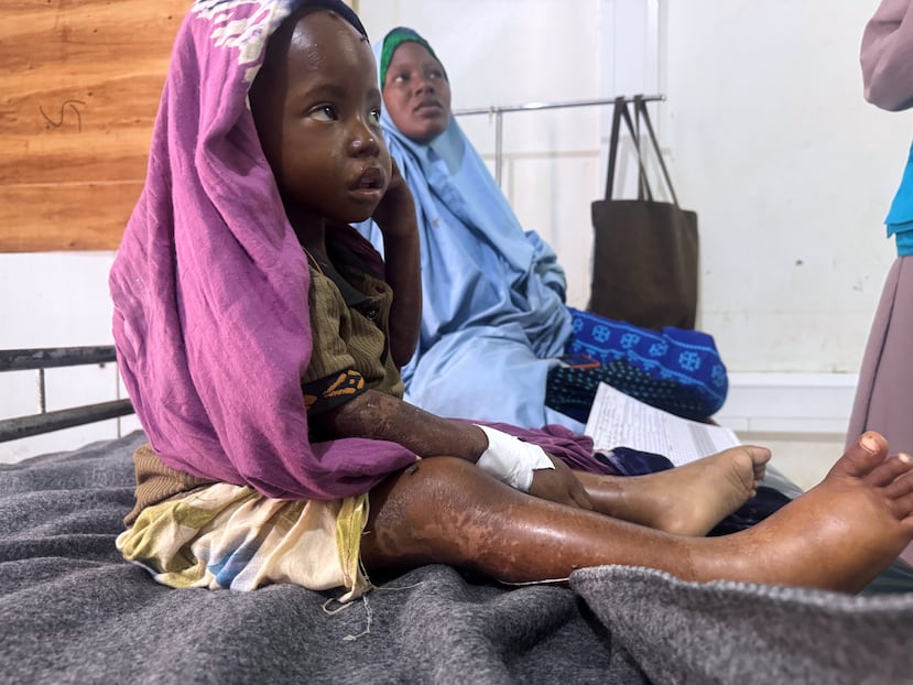 Hawa Ali sostiene a su hijo, Ramadan Osmanin, quien sufre de desnutrición, en el Hospital General Kimanyo.