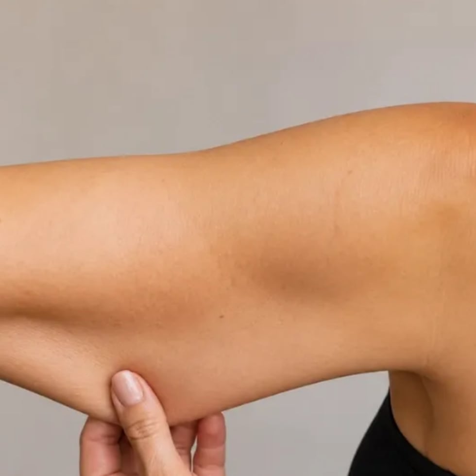 Suele estar relacionada con dos factores: el aumento del tejido adiposo y la disminución del tono muscular.
