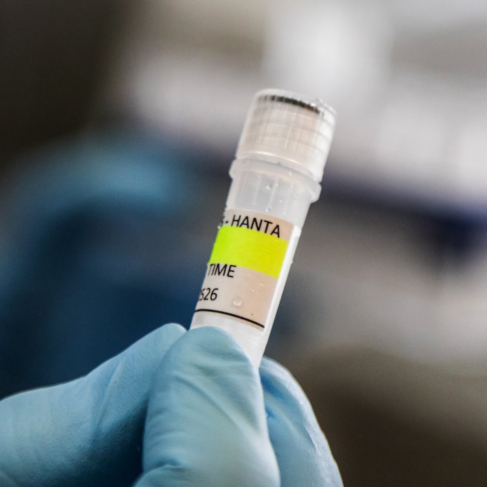 Aunque se han documentado, al menos, 38 especies de hantavirus a nivel mundial, solo un número limitado de ellas causan enfermedades en humanos.