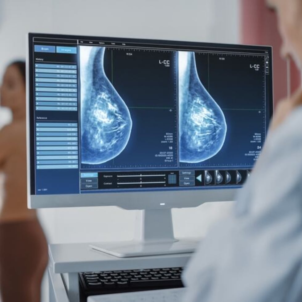 The research will seek to encourage women to get mammograms through three educational efforts.