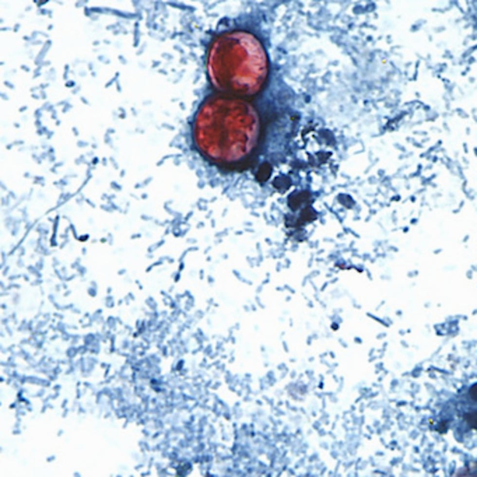 Foto tomada a través de un microscopio cedido por los CDC, muestra oocistos de Cyclospora cayetanensis encontrados en una muestra de heces frescas que había sido preparada con una solución de formalina y teñida con safranina.